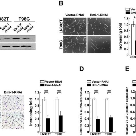 Knockdown Of Bmi 1 Reduces Glioma Cell Promtoed Angiogenesis In Vitro