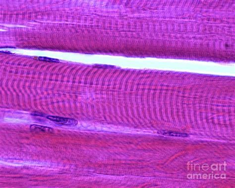 Muscle Fibres Photograph By Jose Calvo Science Photo Library Pixels