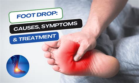 Foot Drop Causes Symptoms And Treatment Pmri Homoeo Hall