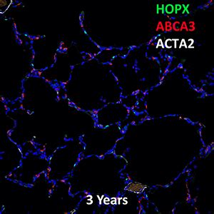 Year Human Lung Hopx Abca And Acta Confocal Imaging