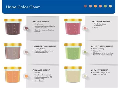 Urine Examination Urine Chemical Examination Ppt