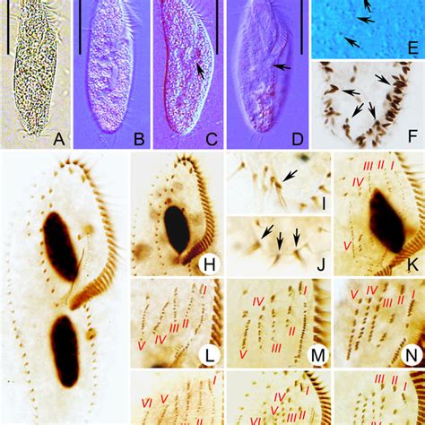 PDF Morphology And Morphogenesis Of A Novel Saline Soil Hypotrichous