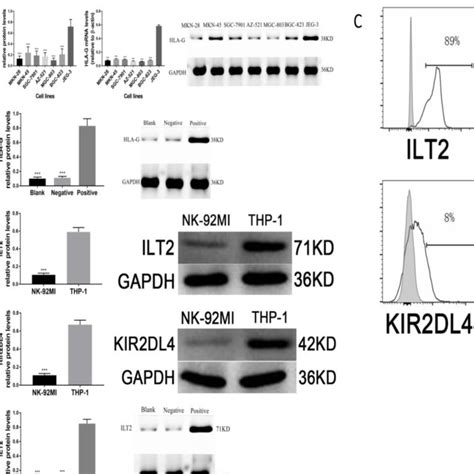 Hla G Expression In Gastric Cancer And The Correlations Between Hla G