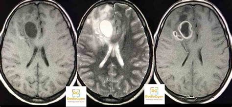 Genitournary Radiology Cases Spotters Set Radiogyan