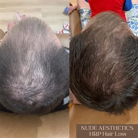 Nude Aesthetics Stay Glowing With Nude