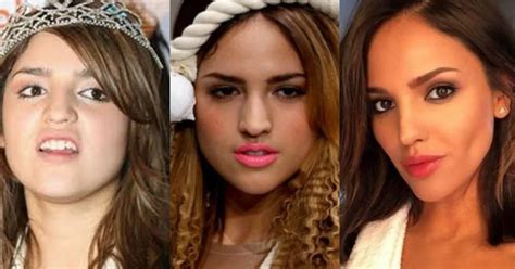 Eiza González Antes Y Después Cirugías La Sorprendente Apariencia De