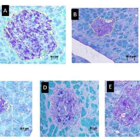 Histology Micrographs Of Pancreas In Rats A Control B Stz C Download Scientific Diagram