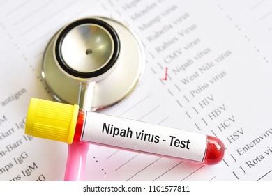 129 Nipah Virus Stock Photos Images Photography Shutterstock