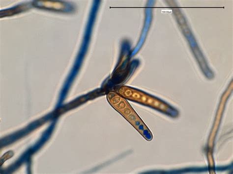 Fun With Microbiology What S Buggin You Exserohilum Rostratum