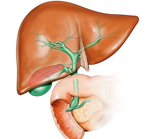 Bile Duct Cancer Symptoms And Treatment | Gallbladder Cancer | Ca ...