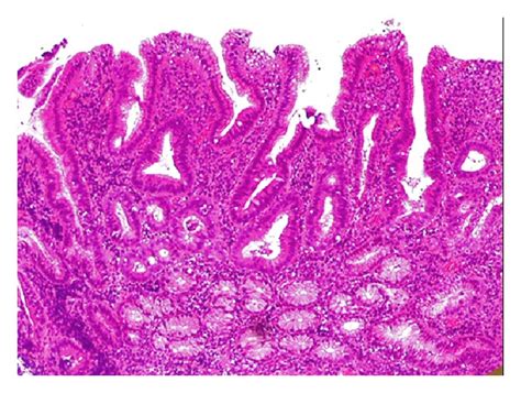 Duodenum Histology Goblet Cells