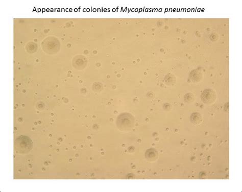 Appearance Of Colonies Of Mycoplasma Pneumoniae Colonies Of M Download Scientific Diagram