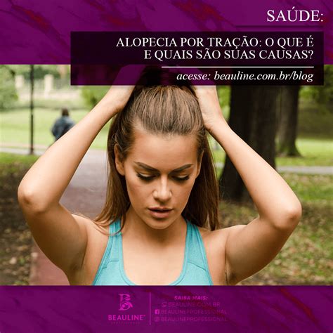 Alopecia por Tração O que é e quais são suas causas Beauline