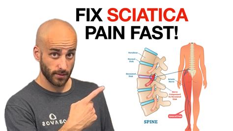 SCIATICA PAIN AVOID THIS HUGE MISTAKE