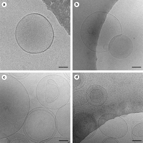 Cryo Em Ultrastructural Characterization Of Evs Isolated From Blood