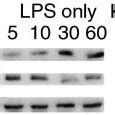 Inhibition Of Ilk Suppresses Ib Ser Phosphorylation And Prevents Its