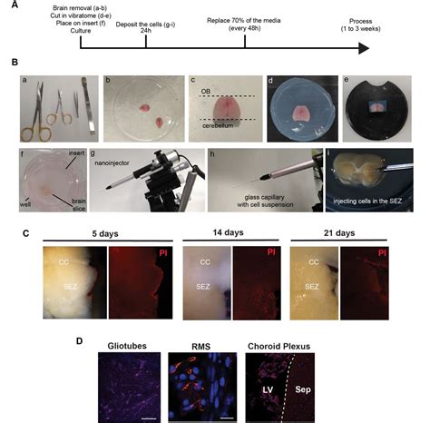 Modelling Glioblastoma Tumour Host Cell Interactions Using Adult Brain