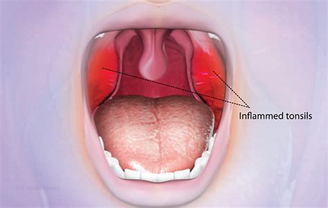 Health Condition Symptoms Causes Treatment And More