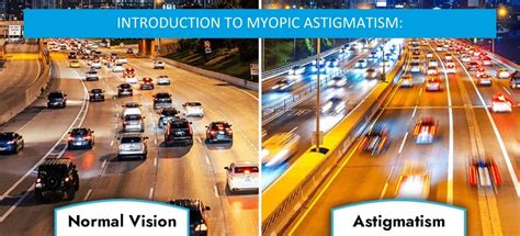 Introduction To Myopic Astigmatism Types Causes Symptoms