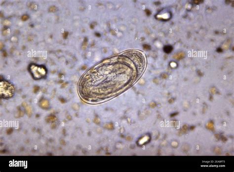 Necator Americanus Ancylostoma Duodenale Huevo Fotografía De Stock Alamy