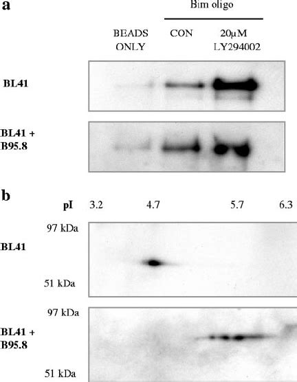 Expression Of Foxo1 Correlates With Expression Of Bcl 6 And Inversely Download Scientific