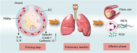 Frontiers Update On Transfusion Related Acute Lung Injury An