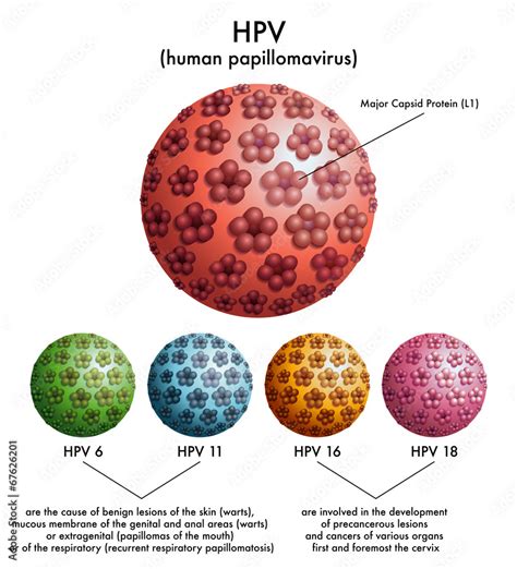 HPV Papilloma Virus Umano Vector De Stock Adobe Stock