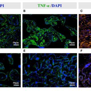 Representative Photomicrographs Of The Immunofluorescent Staining Of