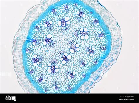 How To Quickly Identify Xylem And Phloem Under A Microscope