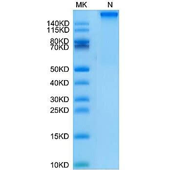 Human HLA A 11 01 B2M KRAS G12D VVVGADGVGK Tetramer Protein MHC HM420T