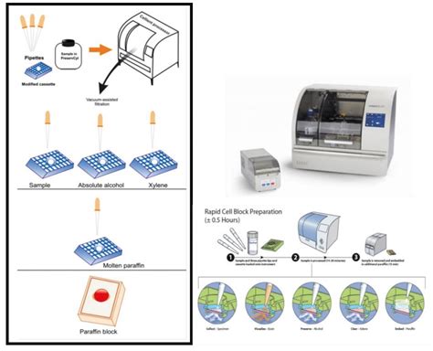 COMPARISON BETWEEN TRADITIONAL AND INNOVATIVE CYTOLOGICAL METHODS FOR