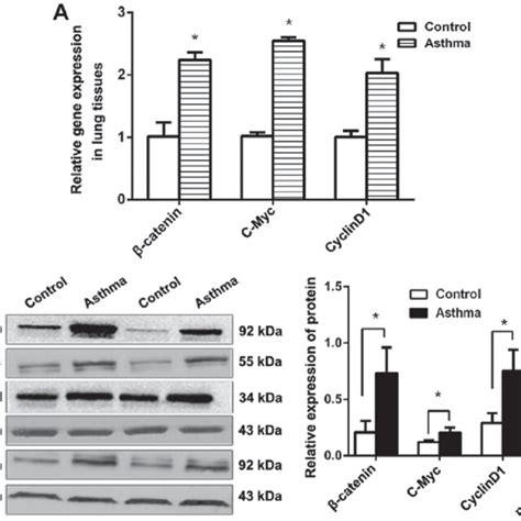 Expression of β catenin p β catenin β catenin c Myc and cyclin D1