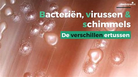 De Verschillen Tussen Bacteriën Virussen En Schimmels Youtube