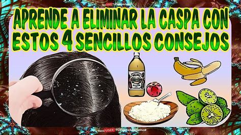 CASPA Aprende A Eliminarlo Con Estos 4 Sencillos Remedios Como