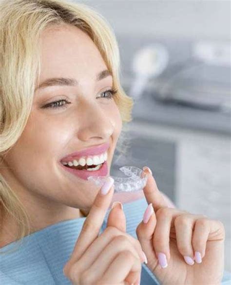 Invisible Aligners Frederick Orthodontist Dublin 1