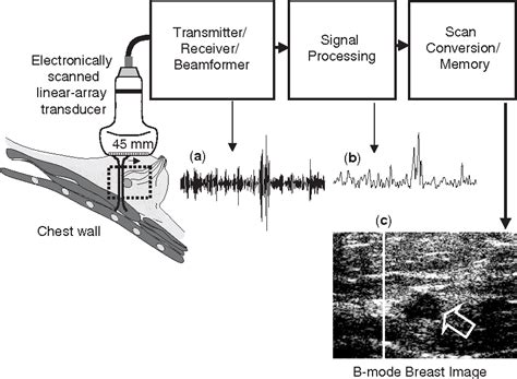 Figure 1 from Ultrasonic Imaging | Semantic Scholar