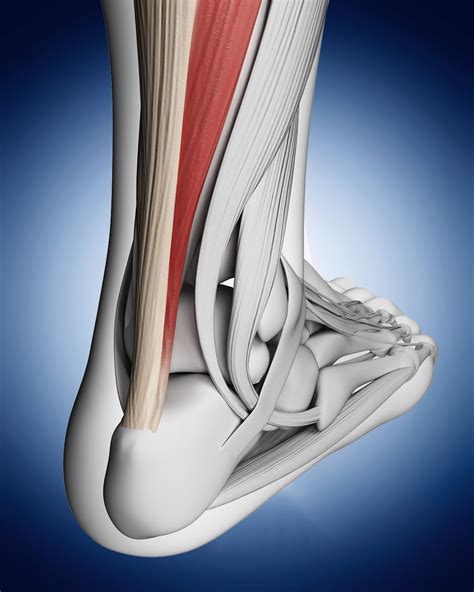 Achilles Tendonitis - Berry Physiotherapy | Mobile Physiotherapy Toronto