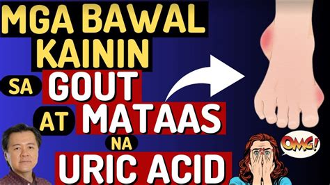 Mga Bawal Kainin Sa GOUT At Mataas Na Uric Acid By Doc Willie Ong