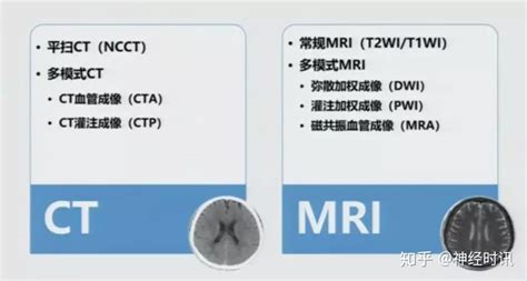 急性缺血性脑卒中的影像学评估 知乎