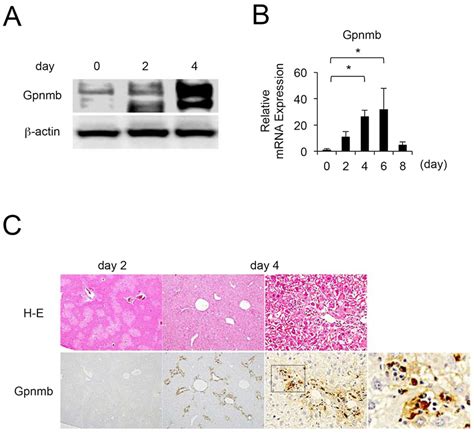 Sequential Changes In And Localization Of Gpnmb Expression Gpnmb