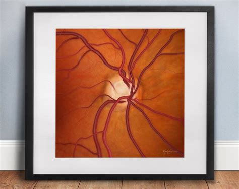 Glaucoma Doctor Gift Optic Nerve Art Cupping C D Eye Etsy