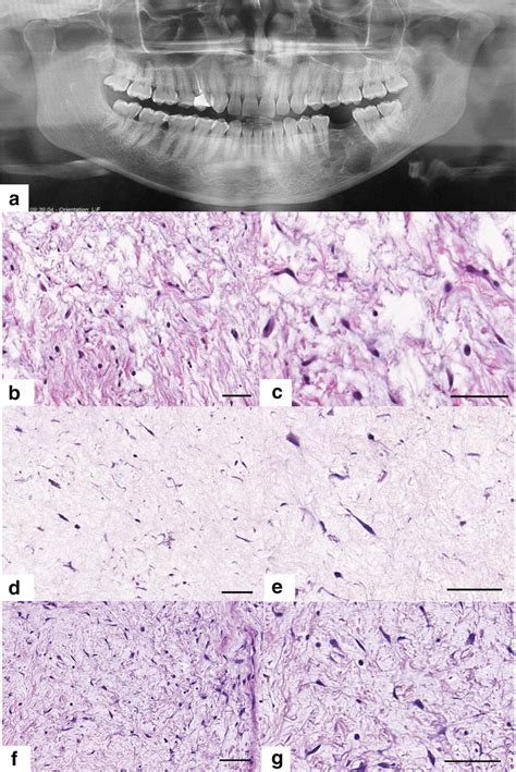 Radiographic And Histopathological Images Of The Original Human