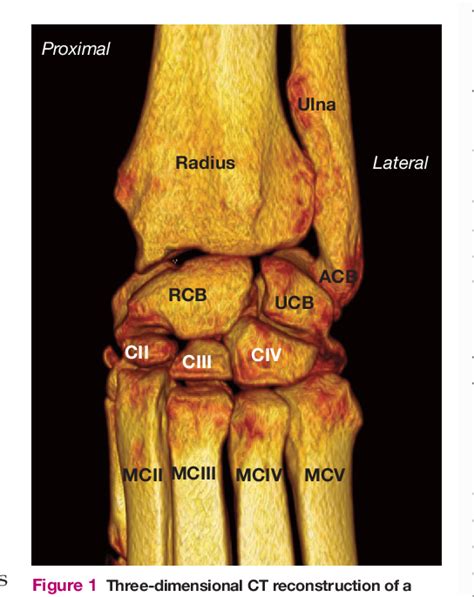 Figure 1 From Management Of Feline Carpal Injuries What Are The