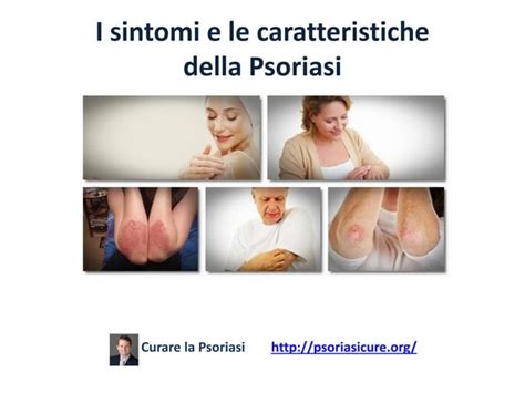 Rimedi Naturali Per Curare La Psoriasi PPT