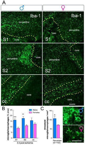 Ijms Free Full Text Early Sex Differences In The Immune