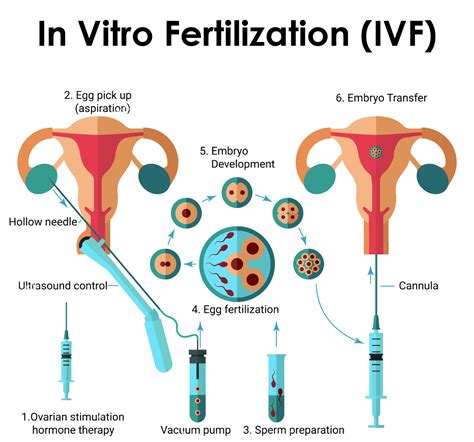 How To Make The Most Out Of Your Ivf Treatment Ivf Treatment Infertility Treatment Ivf