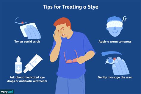 Treatment and Symptoms of a Stye on the Eyelid