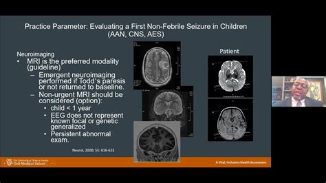 Epilepsy Diagnosis And Seizure Semiology Youtube