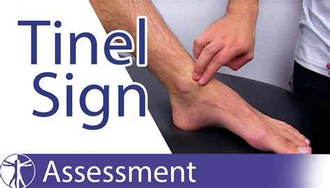 tinel sign   ankle  peripheral nerve injury tarsal tunnel