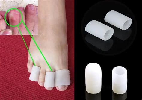 Silicone Gel Tubo Toe Joanete Calos Bolhas Protetor Gel De Prote O